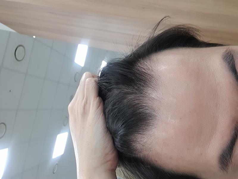 탈모 맞는건가요?