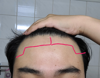 현재 앞머리 