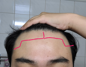 현재 앞머리 