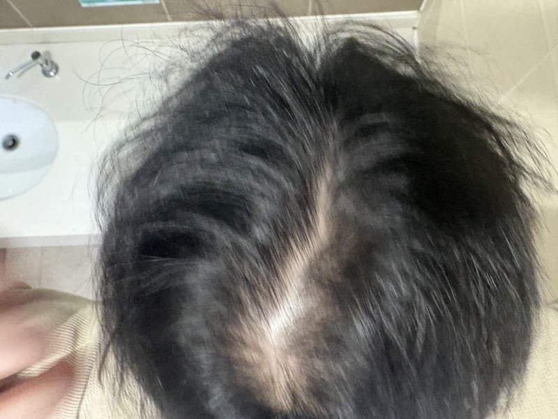 저는 어디서부터 어떻게 치료를해야할까요..