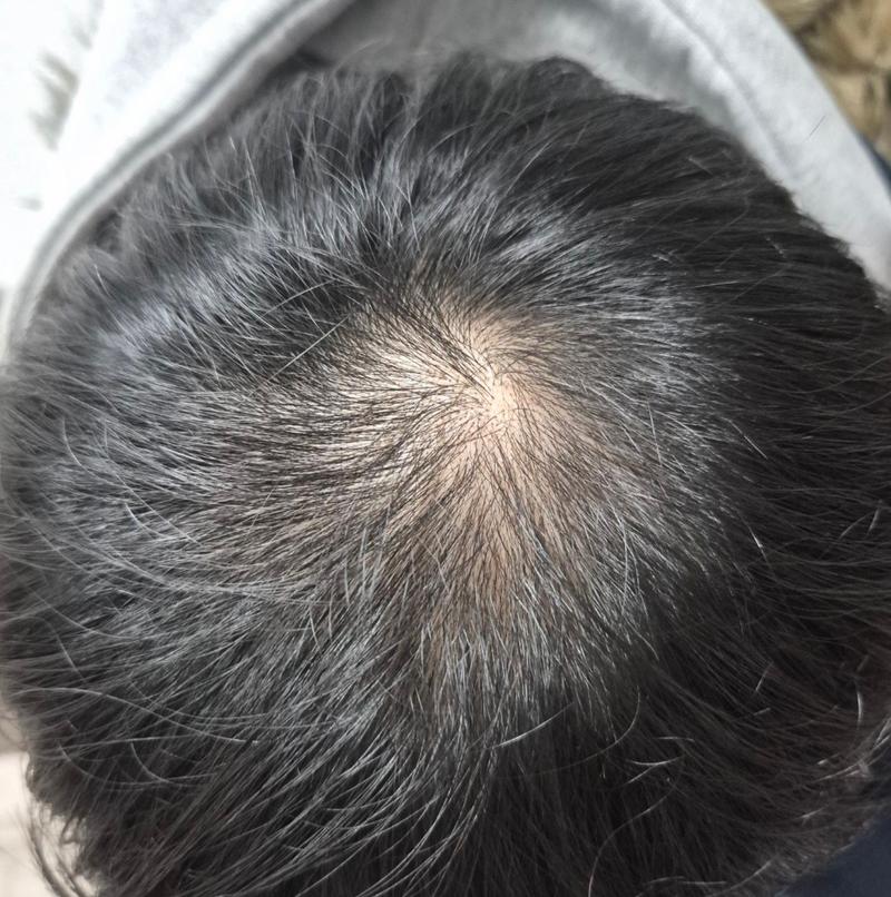 効果があるのでしょうか