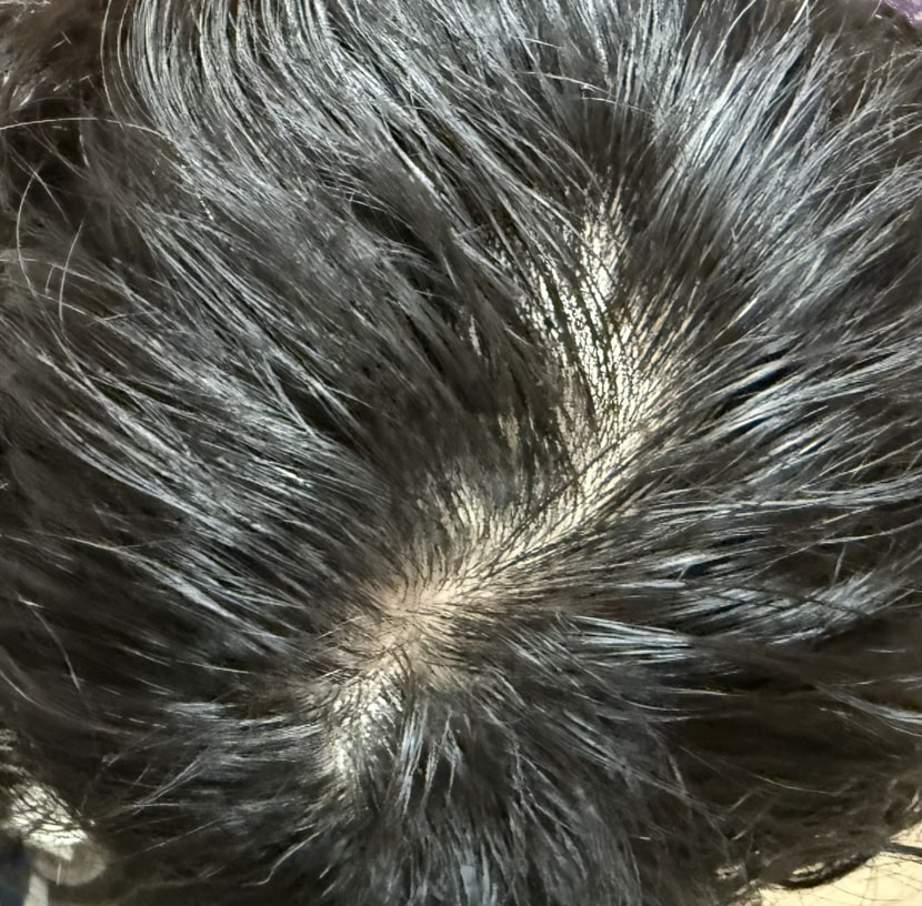 25년 10월 엘크라넬 바른 뒤