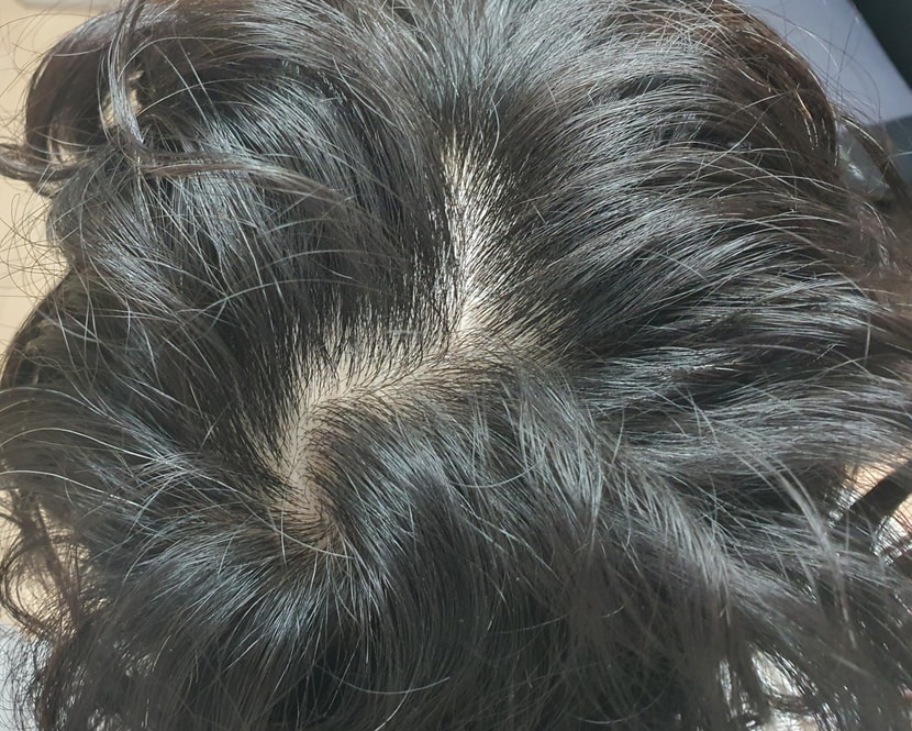 정수리 2 (살짝 기울임)