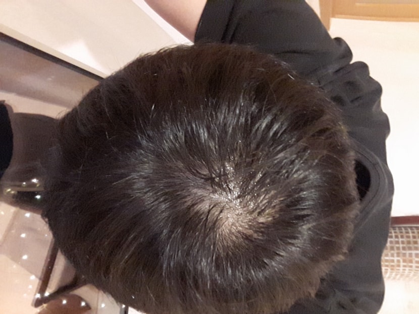 바른 후