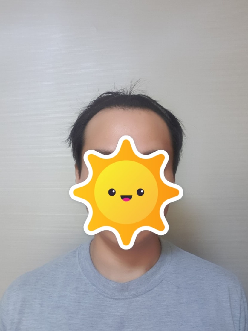 수술전