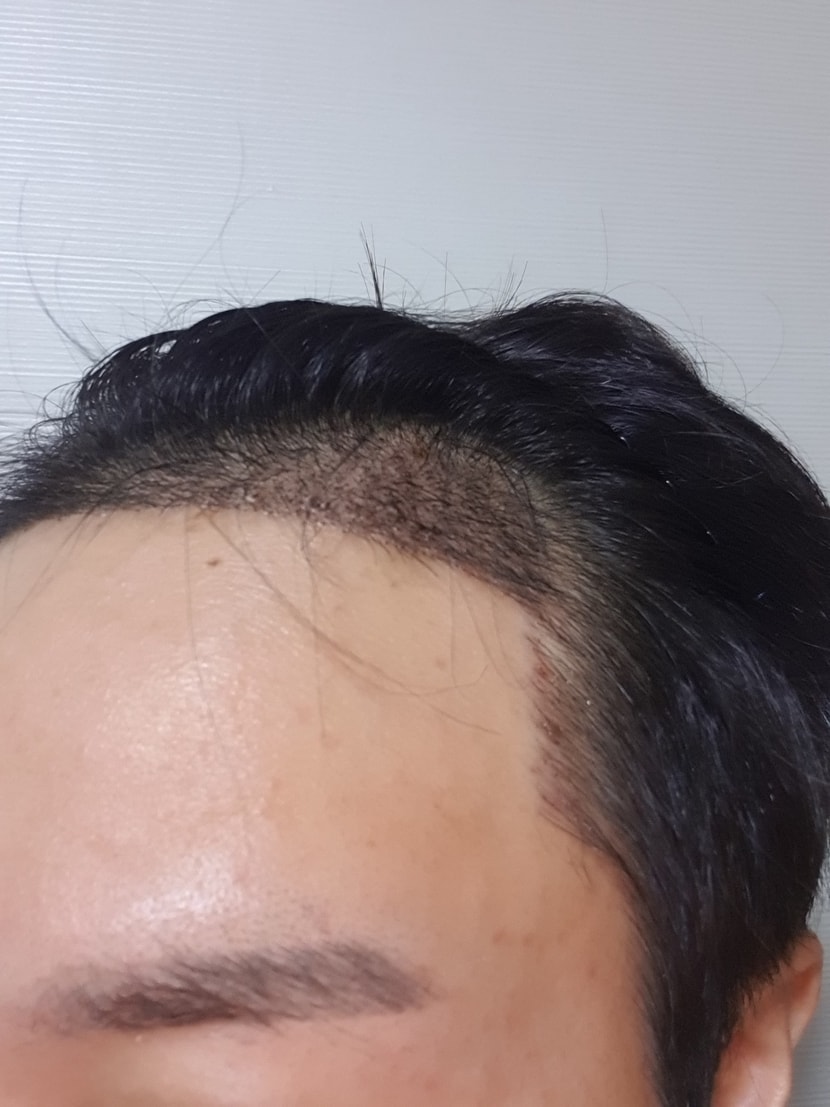 7일차