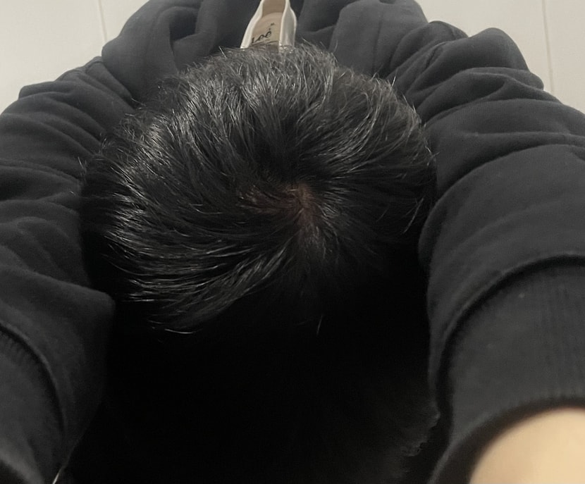 불영향 덜받게 수구려서