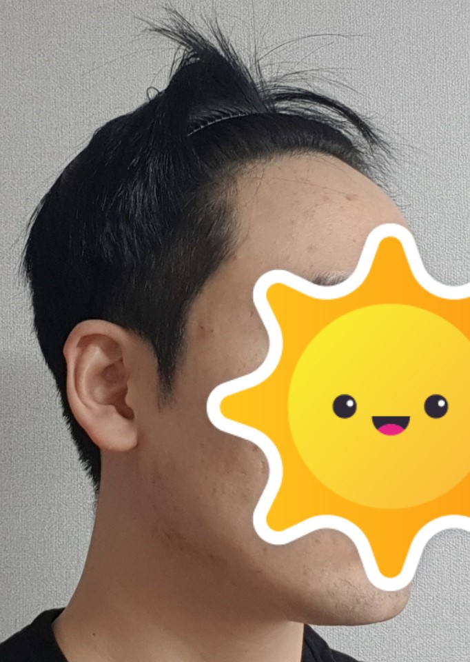 수술전 