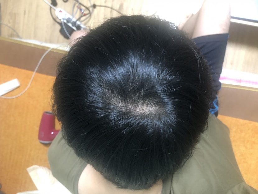 이건 딱 1년전 작년 8월