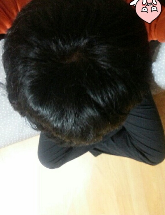 정수리 현재