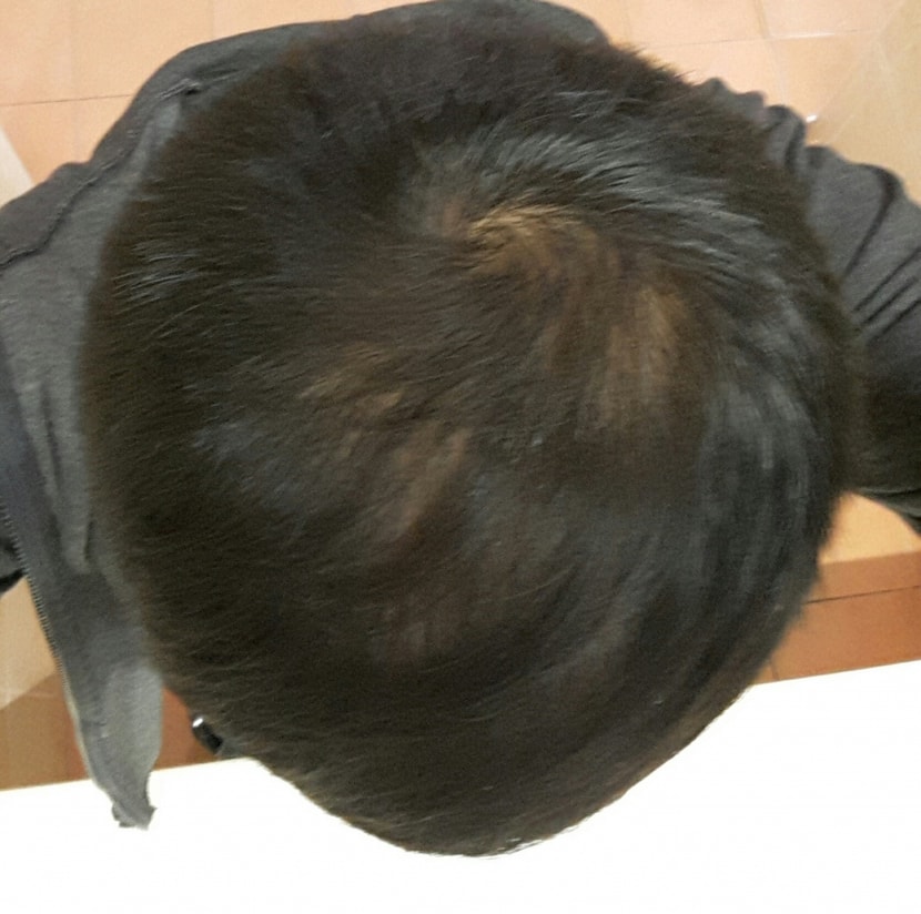 일단 모자를 몇시간 쓰고있다가 벗은거구요 머리는 스포츠머리에 가까운 짧은머리입니다