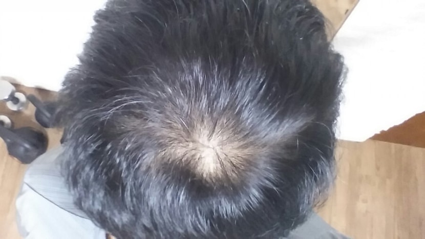 222일차