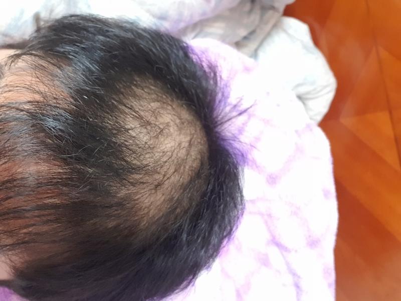 관리하니까 조금 나아지긴 했네요 (사진 3장정도 첨부)