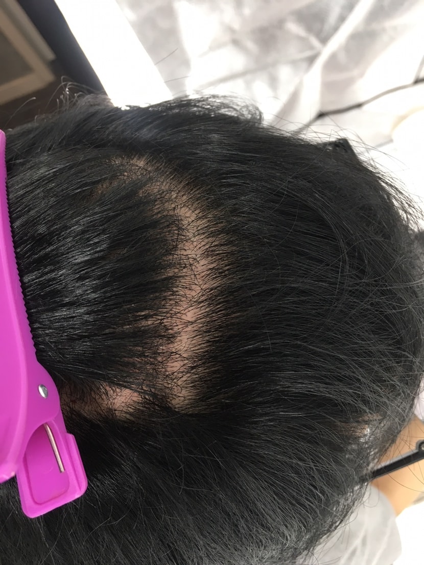 이번주 월요일날 병원에서 찍은사진2