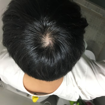 화장실 형광등