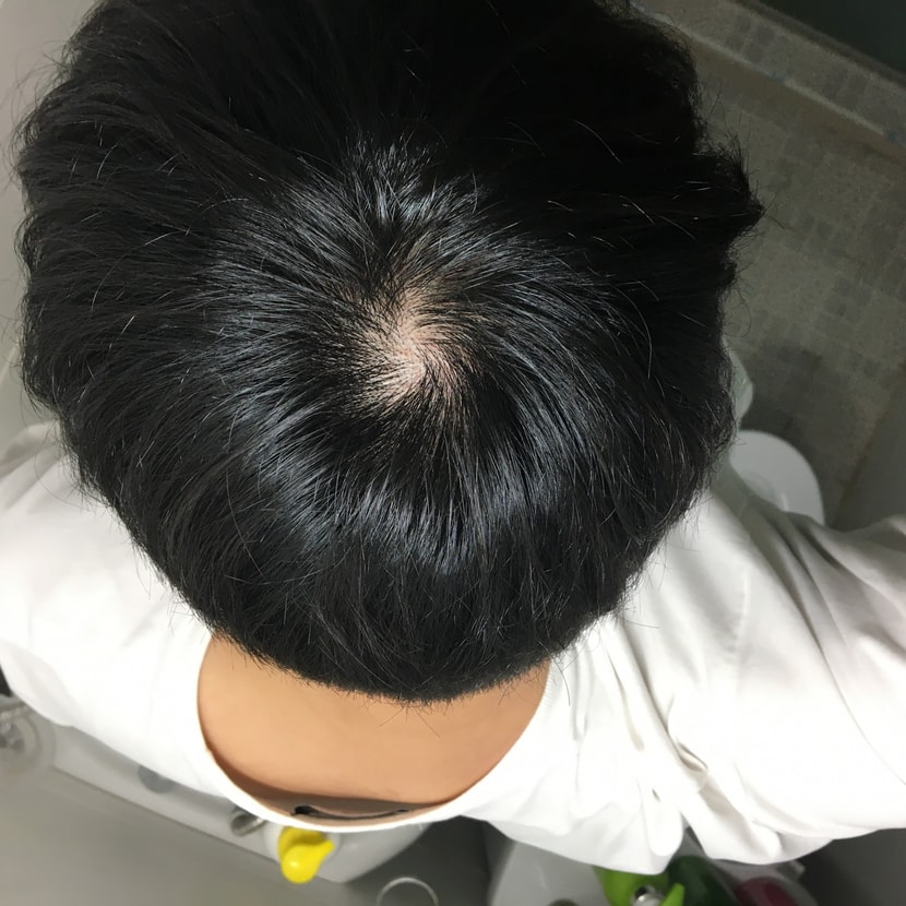 화장실 형광등