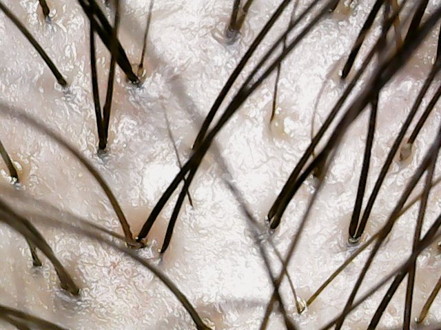 정수리