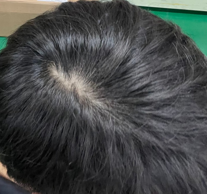약 먹은지 1일차