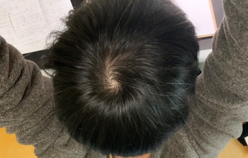 정수리
