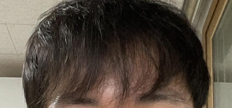 프페 카피약 510일차 후기