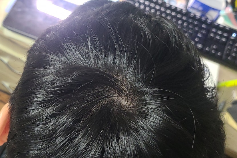 오늘(헤드폰에 눌려서 그렇지 숱 자체는 제일 빽빽한것 같습니다)