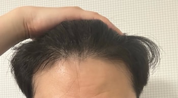 2024.06 헤어라인