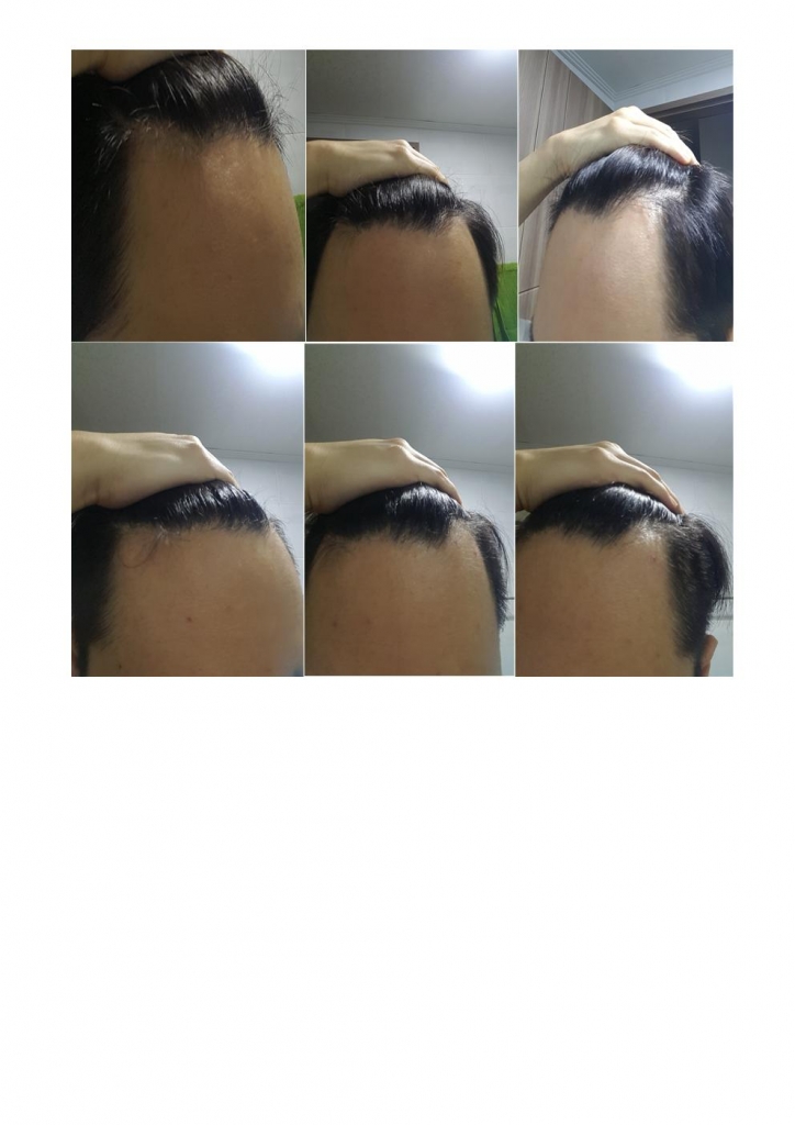 머리