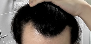 1년전