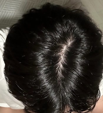 1년전