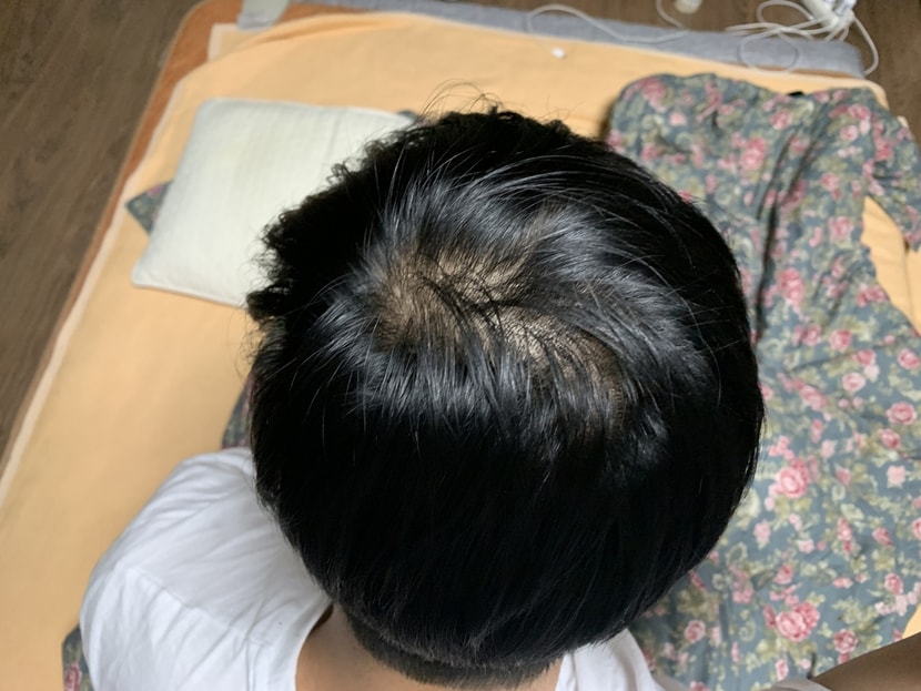 하... 두피가 많이 보이네요