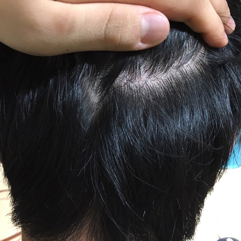 뒷머리입니다
