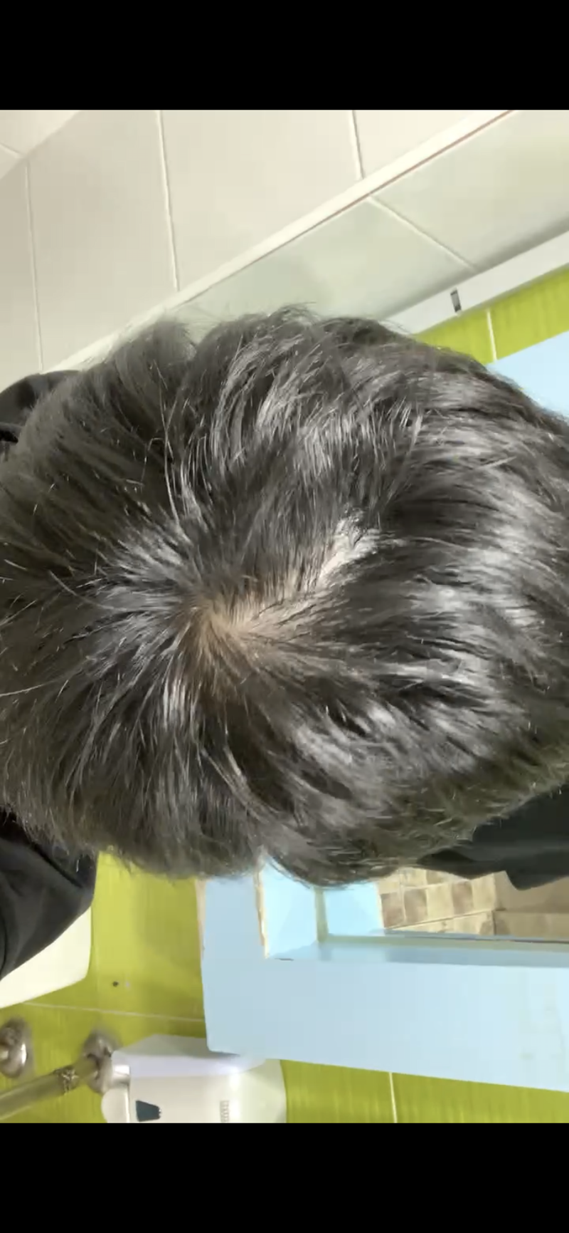 23살 남자 고민입니다