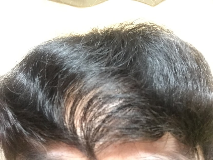 17년 3월 현재
