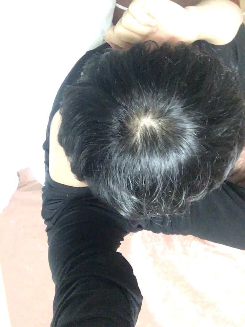 현재 머리상태 (1)