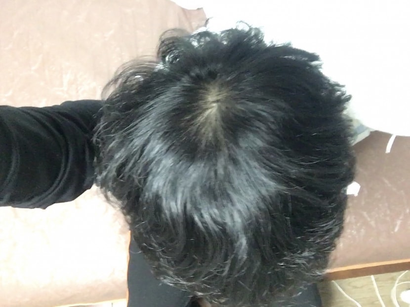 현재 머리상태 (3)