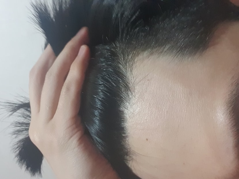 옆1