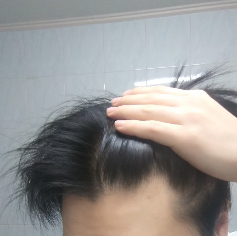 왼쪽사진