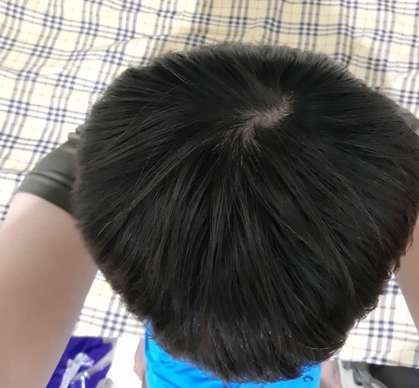 머리 안감고 윗머리 촬영(셀카)