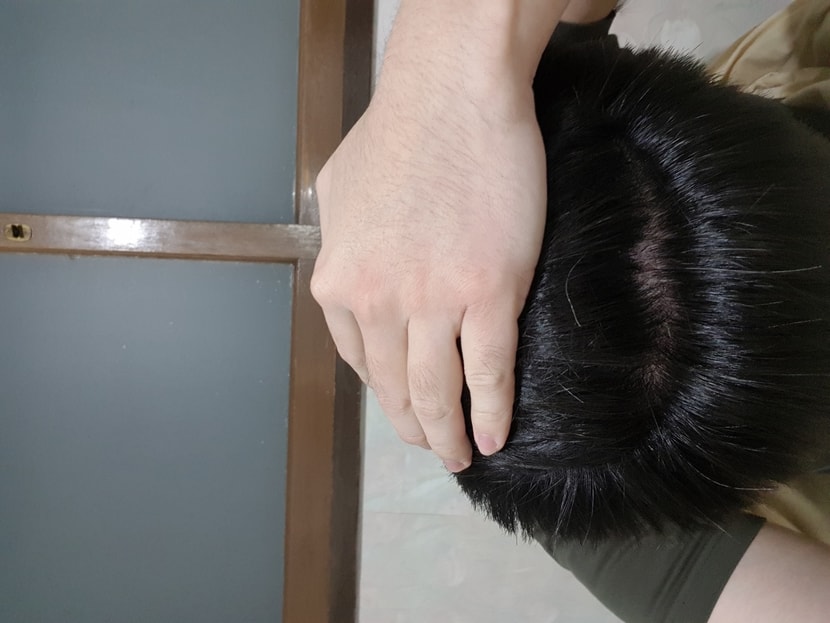 속알머리겸 새치