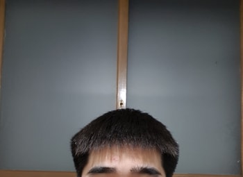 1월 29일 머리(정면)