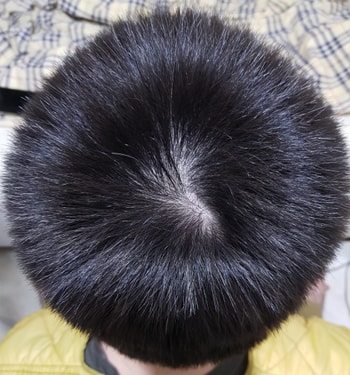 정수리