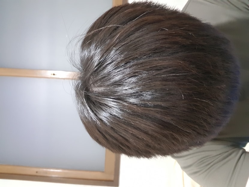 숙여서 찍은 윗머리 입니다 각도 차이 있음