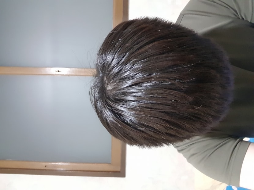 숙여서 찍은 윗머리 각도 차이 있음을 감안