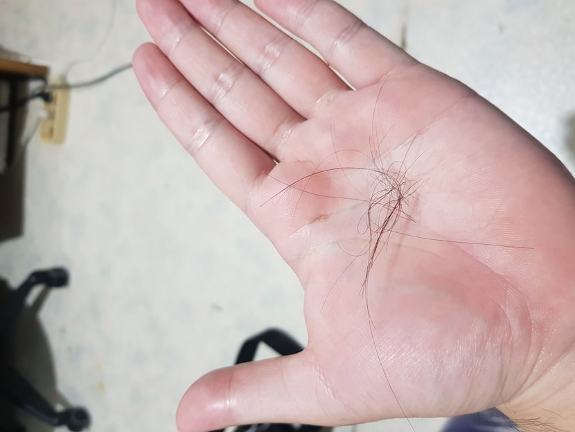 오늘 샤워후 머리 가닥 입니다. 대략 25가닥이고 많은건가요?