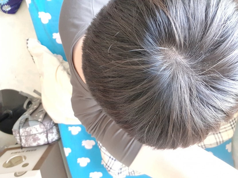 정수리1