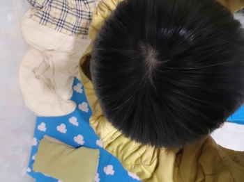 23년 1월 30일 정수리 2