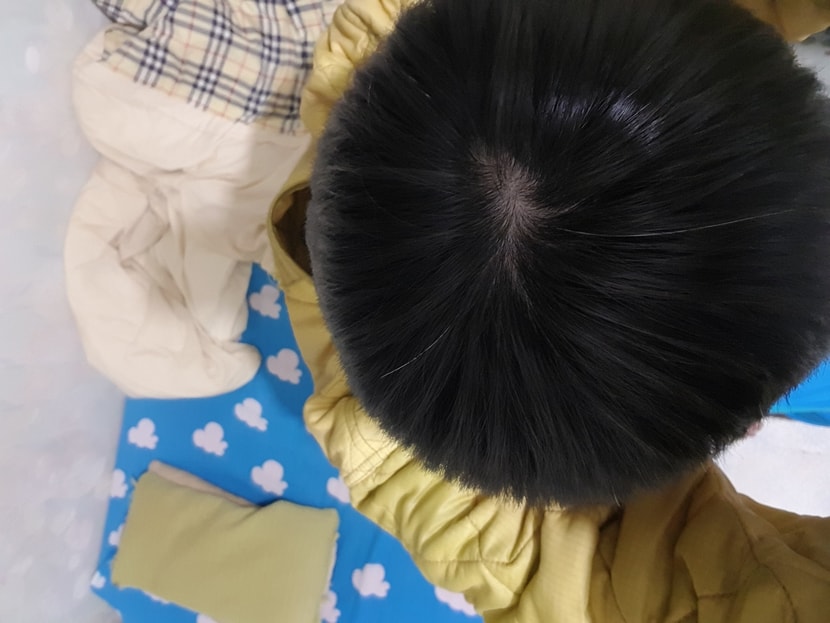 23년 1월 30일 정수리 2