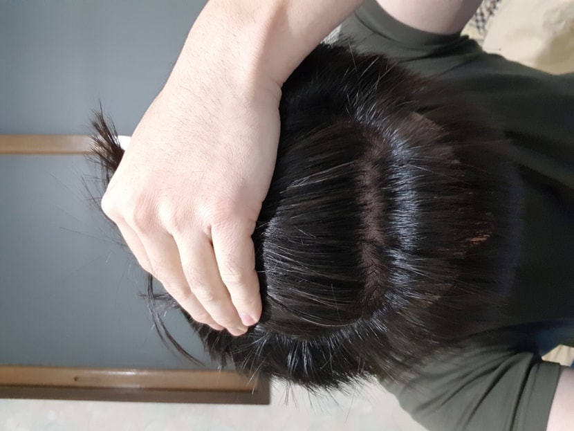 깐머리2