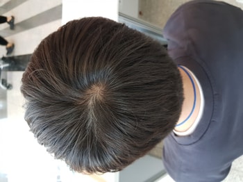 22년 11월 13일(정수리 머리길었을때)