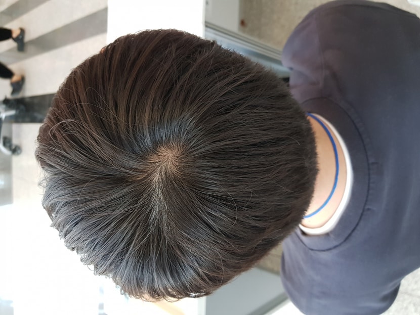 22년 11월 13일(정수리 머리길었을때)